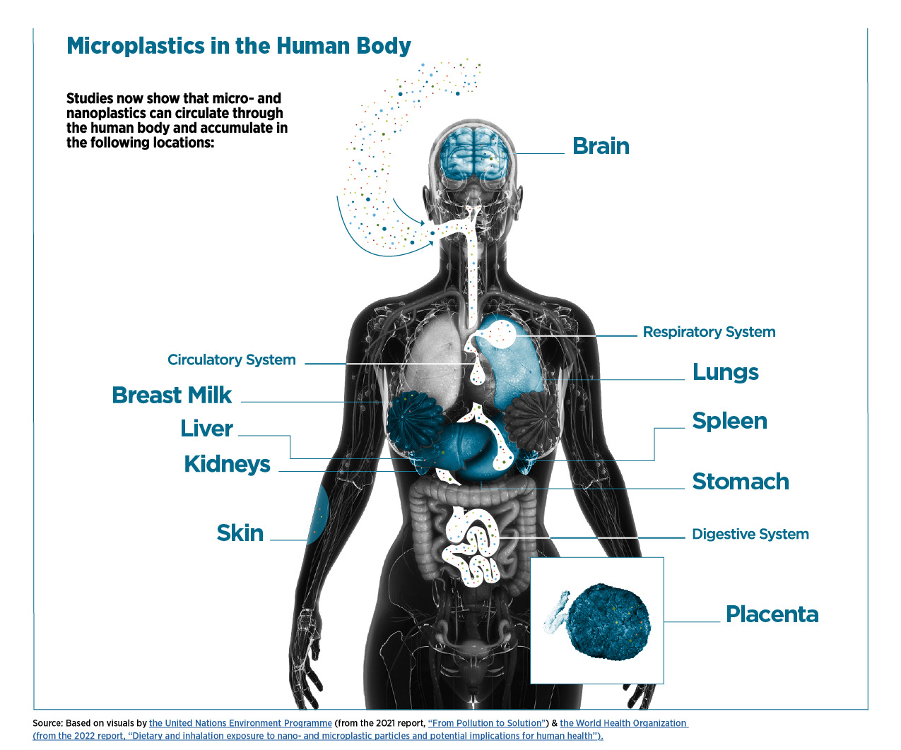 Microplastics have been found in human blood, brain tissue, and organs at alarming levels